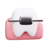 Braces Dental Care Clinic Healthcare Orthodontic